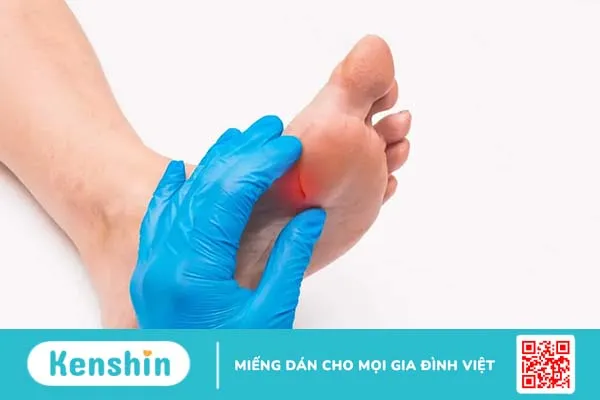 Da của người bị tiểu đường: Tại sao phải chăm sóc đặc biệt?