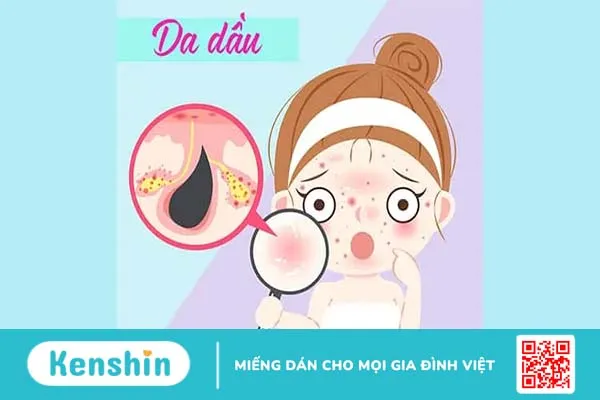 Da dầu và da hỗn hợp: Đâu là sự khác biệt?