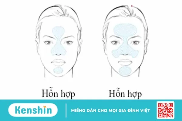 Da dầu và da hỗn hợp: Đâu là sự khác biệt?