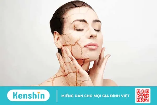 Da khô do biến chứng tiểu đường