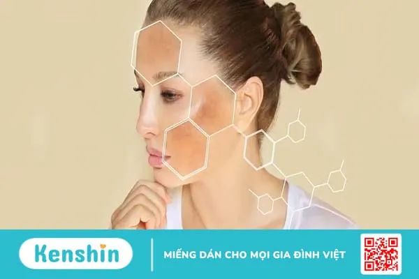 Da mặt bị cháy nắng làm sao để trắng lại?