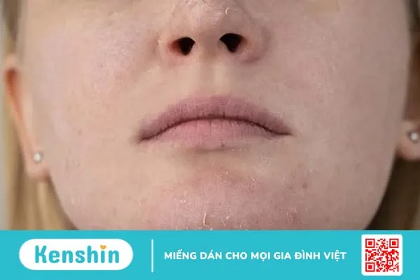 Da mặt khô nên dùng gì? Cách chăm sóc da khô hiệu quả