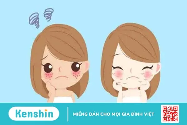 Da nhạy cảm là như thế nào? 10 dấu hiệu nhận biết phổ biến