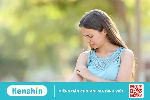 Da nổi mẩn đỏ ngứa: 15 “thủ phạm” và cách kiểm soát hiệu quả
