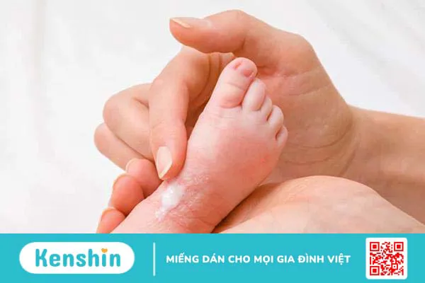 Da trẻ bị khô là thiếu chất gì? Bật mí các cách trị khô da ở trẻ em