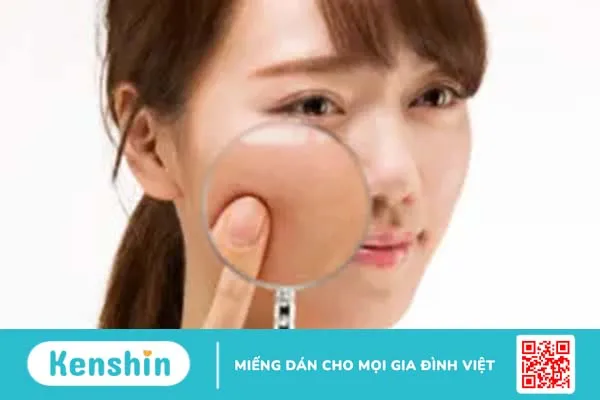 Da xỉn màu, sạm đen: Nguyên nhân và cách khắc phục