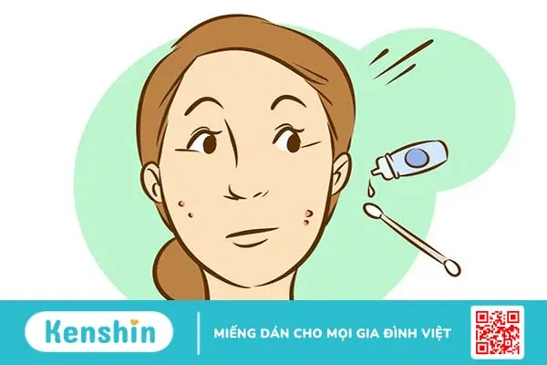 Đánh bay mụn sưng đỏ siêu nhanh với 5 mẹo đơn giản sau