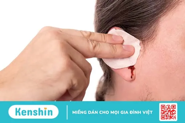 Đặt ống thông khí màng nhĩ – Quy trình thực hiện và những lưu ý