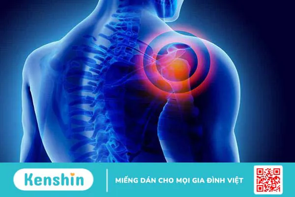 Đau bả vai có phải là bệnh lý nguy hiểm? Cách điều trị là gì?