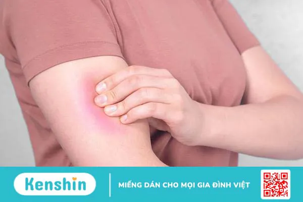 Đau bắp tay: Tại sao phải nhận biết để điều trị sớm?