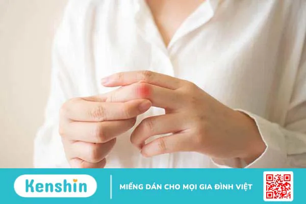 Đau các khớp ngón tay là bệnh gì? Khắc phục các khớp ngón tay bị đau