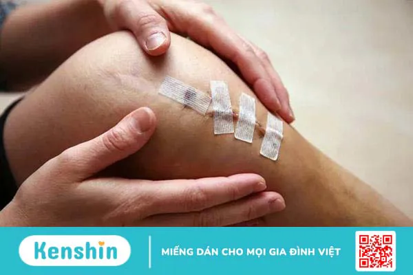 Đau đầu gối nhưng không sưng – Biểu hiện của nhiều bệnh