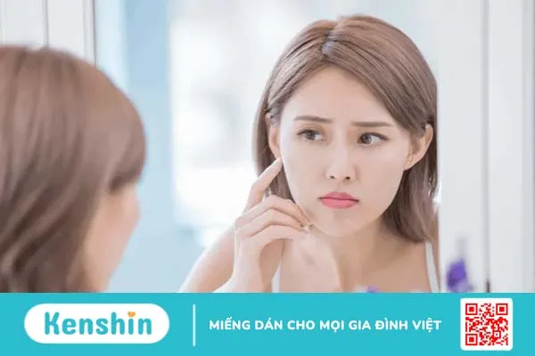 Dầu dừa trị mụn: Cứu cánh cho làn da khô