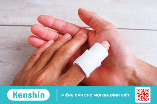 Dấu hiệu đứt gân ngón tay và các chấn thương thường gặp