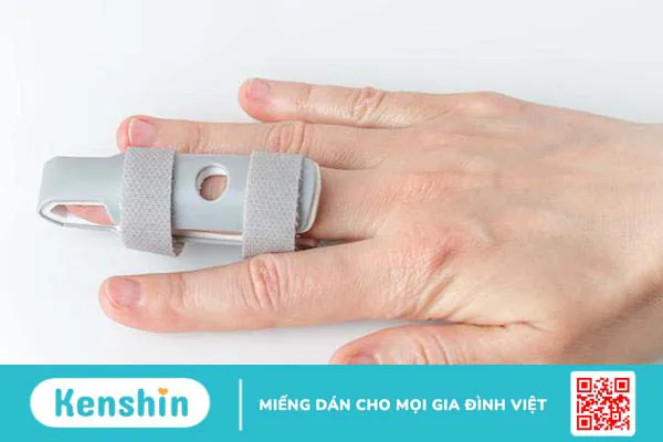 Dấu hiệu đứt gân ngón tay và các chấn thương thường gặp