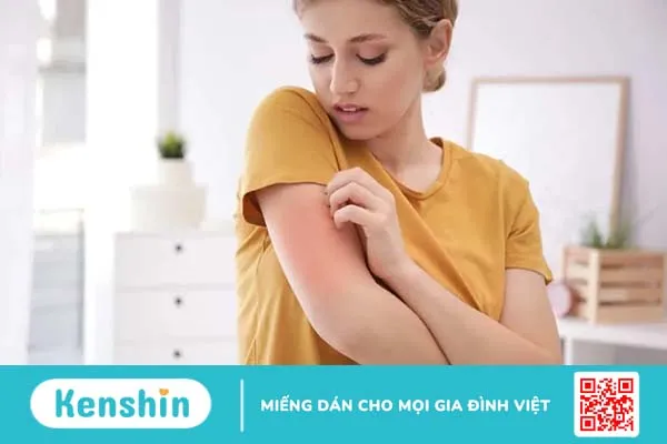 Dấu hiệu ngộ độc hoa đu đủ đực và cách phòng ngừa