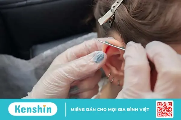 Dấu hiệu nhiễm trùng khi bấm lỗ tai và cách xử trí