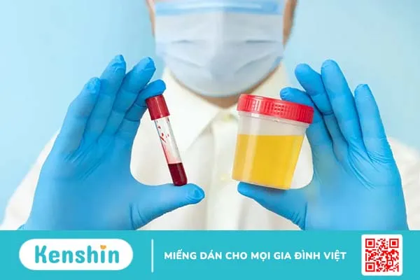 Dấu hiệu suy thận giai đoạn đầu: Biết để bảo vệ thận!