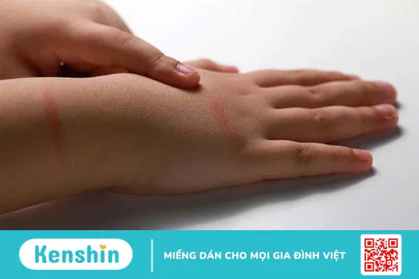 Dấu hiệu trẻ bị bạo hành: Những “manh mối” nào không nên bỏ qua?