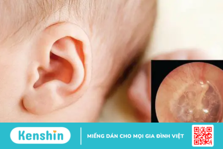 Dấu hiệu viêm tai giữa ở trẻ sơ sinh – Làm sao nhận biết chuẩn xác?