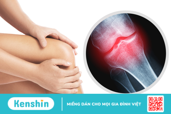 Dấu hiệu xương không lành: Điều gì bạn cần biết?