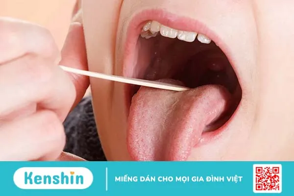 Đau họng một bên là bệnh gì? Điểm mặt 9 nguyên nhân thường gặp