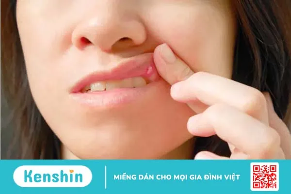 Đau họng một bên là bệnh gì? Điểm mặt 9 nguyên nhân thường gặp