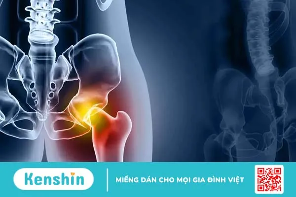 Đau khớp háng bên trái là bệnh gì? Nguyên nhân do đâu?