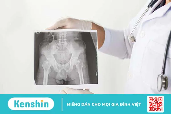 Đâu là các xét nghiệm giúp chẩn đoán bệnh viêm cột sống dính khớp?