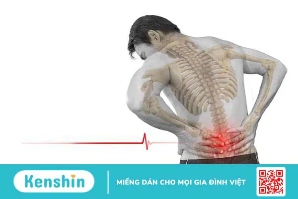 Đau lưng cấp là gì? Làm sao để giảm và ngăn ngừa đau lưng?