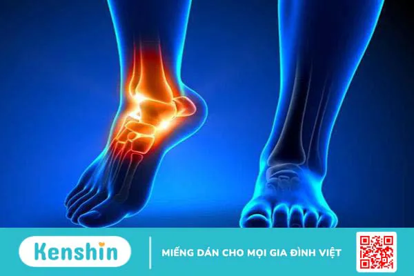 Đau nhức mắt cá chân: Những điều cần biết