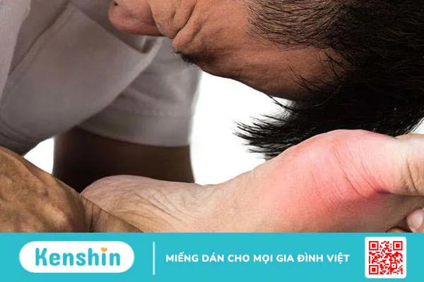 Đau nhức xương khớp là bệnh gì? Cách nhận biết sớm