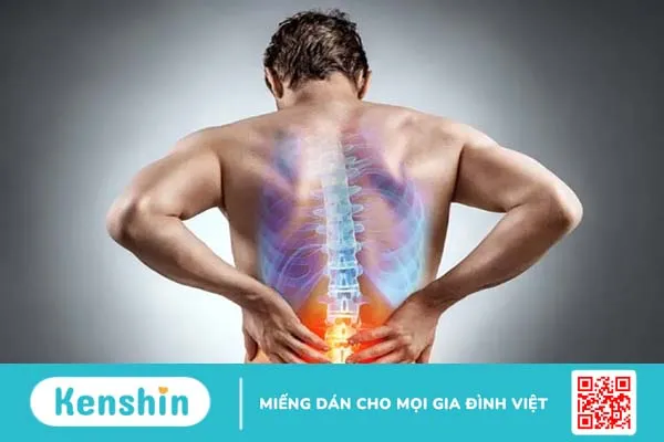 Đau sỏi thận là đau ở đâu? Phân biệt đau lưng và đau thận