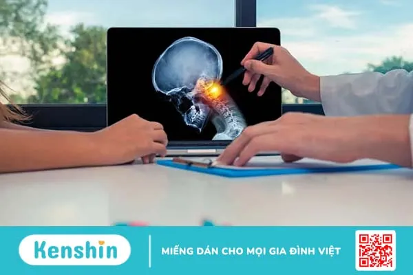 Đau trên đỉnh đầu là bệnh gì? Đọc để cảnh giác!