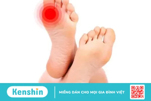 Đau ụ ngón chân là gì ? có nguy hiểm hay không ?