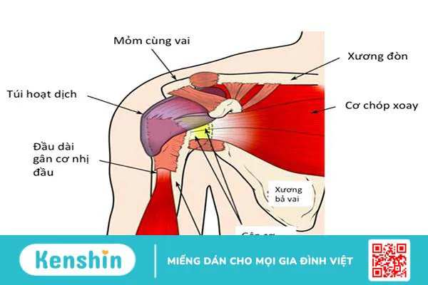 Đau vai: Khi nào bạn nên gặp bác sĩ?