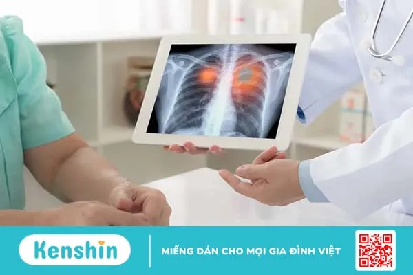 Đau vùng lưng sau phổi có phải là dấu hiệu ung thư phổi?