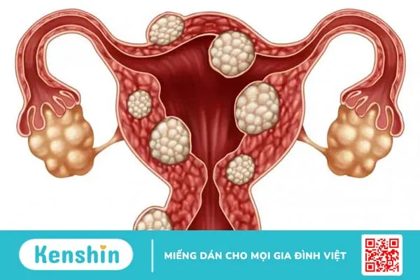 Đau vùng xương chậu: Nguyên nhân do đâu?