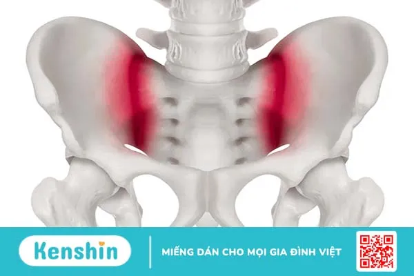 Đau vùng xương chậu sau lưng, bên trái, bên phải là bệnh gì?