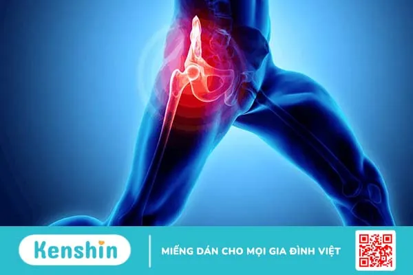 Đau vùng xương chậu sau lưng, bên trái, bên phải là bệnh gì?