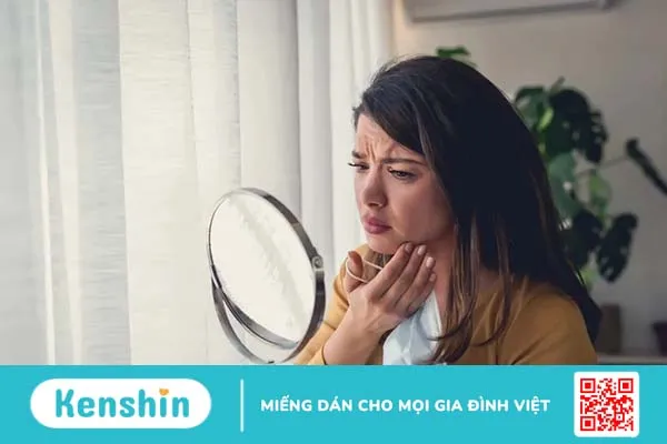 Đeo khẩu trang bị mụn: Làm sao để khắc phục?