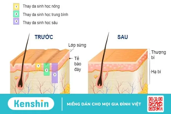 Dẹp bỏ tự ti nhờ 10 phương pháp trị thâm mụn hiệu quả