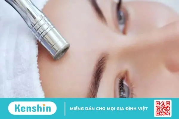 Dẹp bỏ tự ti nhờ 10 phương pháp trị thâm mụn hiệu quả