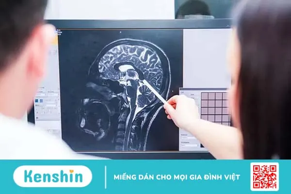 Đi tìm lời giải bệnh teo não sống được bao lâu