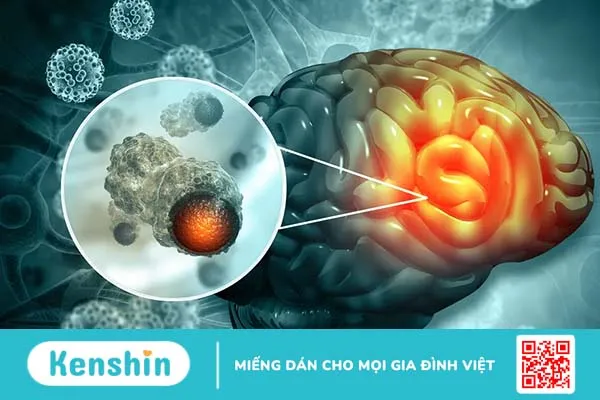 Đi tìm lời giải ung thư di căn sống được bao lâu?