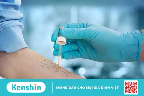 Dị ứng bia có phổ biến không? Cách chẩn đoán và điều trị như thế nào?