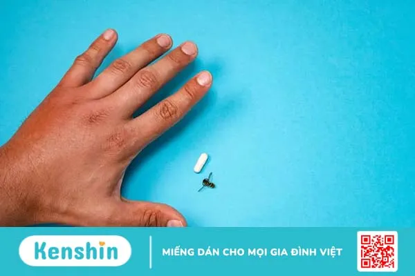 Dị ứng côn trùng đốt: Dấu hiệu nhận biết và cách xử trí hiệu quả