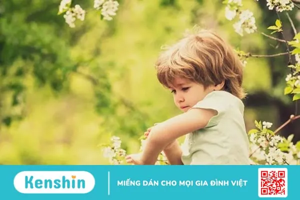 Dị ứng mật ong: Triệu chứng nhận biết và phương pháp điều trị hiệu quả