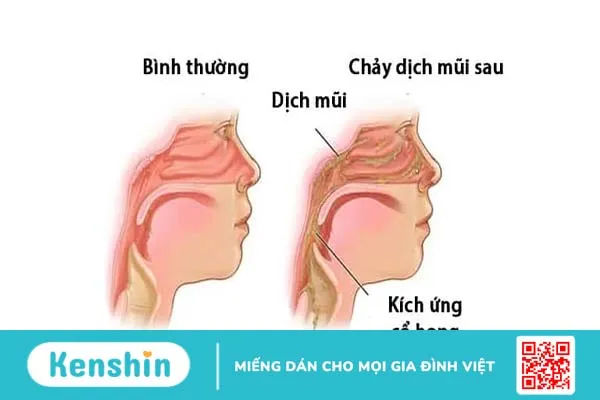 Dị ứng mũi và mắt: Biện pháp chữa trị hiệu quả !