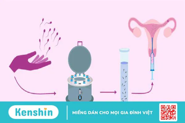 Dị ứng tinh trùng: Nguyên nhân và cách điều trị